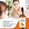 Turmeric Freckle Whitening Serum Anti-oxidant Nourishing Moisturizing Repair Skin Brighten Fade Dark Spot Essence Face Care 3