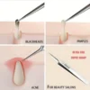 Ultra-Fine No. 5 Cell Acne Blackhead Clip Tweezers Beauty Salon Special Acne Needle Facial Care Tool 6