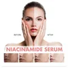 Hoygi Niacinamide Essence Tightens and Moisturizes Pores Lightens Acne Marks and Spots Moisturizes and Brightens Skin Makeup 4