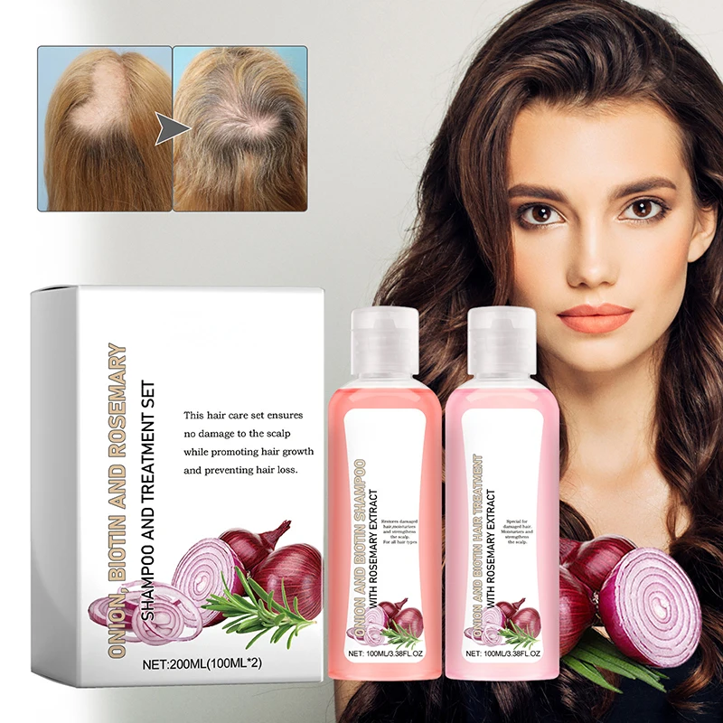 

Onion Rosemary Hair Shampoo Set Treatment Hair Loss Thinning Hair Nourishes roots Thickens The Scalp Hair Growth Shampoo 200ml