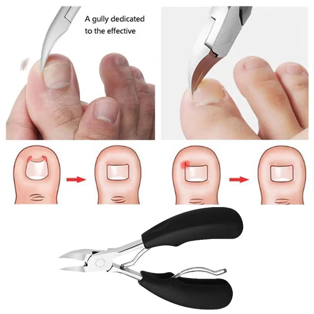

1PC Paronychia Tools Nail Cutter Dead Skin Remove Cuticle Manicure Toenail Clippers Scissors Anti-Splash Trimmer T7M7