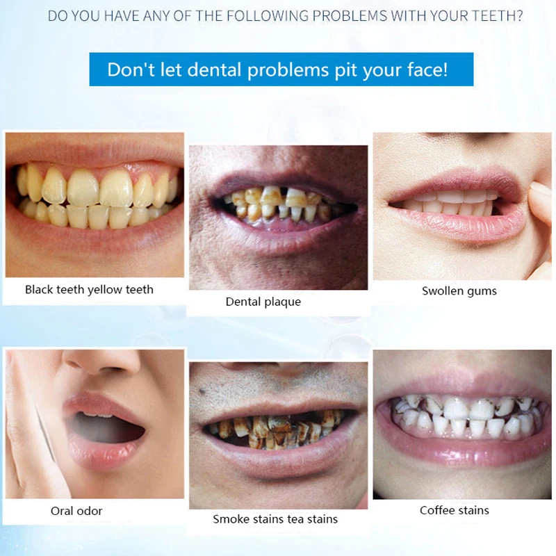 120ml Tooth Whitening Tooth Powder , Remove Smoke Stains, Coffee Stains, Tea Stains, Freshen Bad Breath, Oral Hygiene