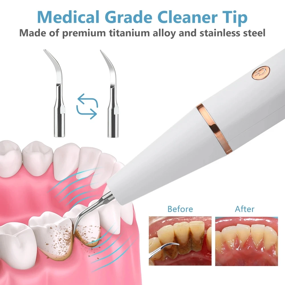 Sonic Cleaner Scaler Calculus Cleaning Tartar Dental Whitening Devices Eliminator Remover Ultra Electic Sonic Tooth Cleaner