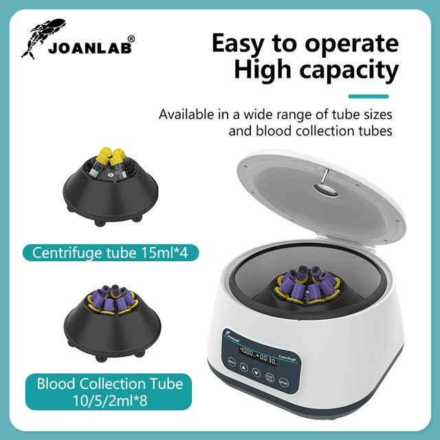 실험실 효율성을 극대화하는 혁신적인 PRP 원심 분리기