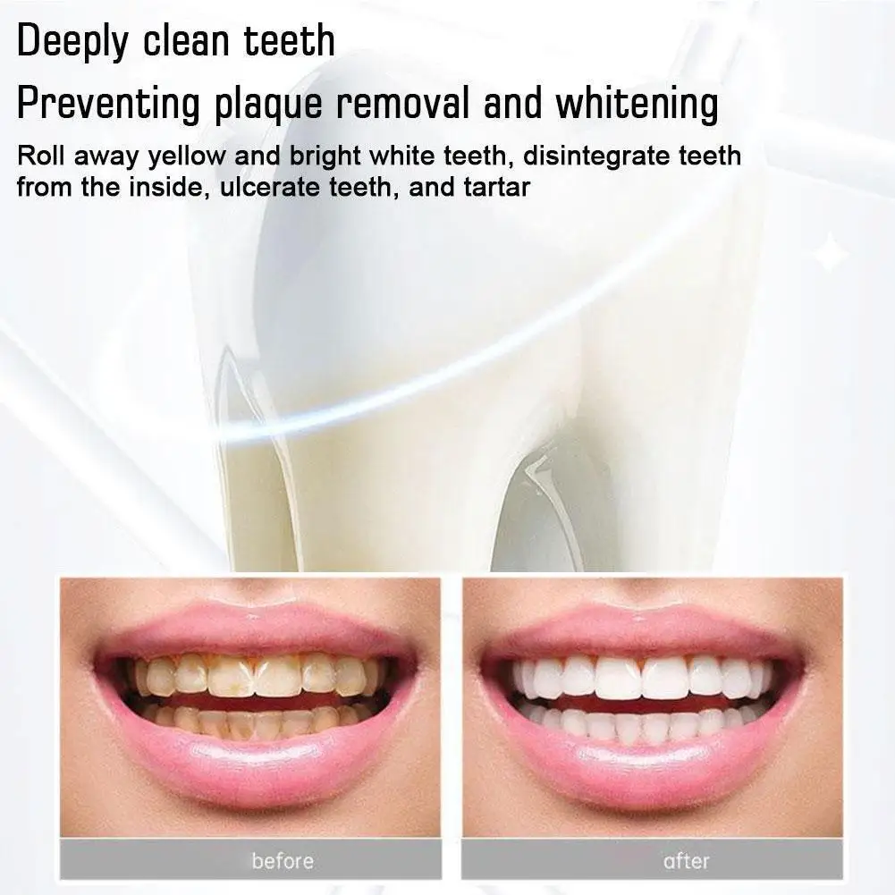 Probiotic Whitening Toothpaste Brightening Stain Removing Sp-4 Probiotic Toothpaste Fresh Breath Teeth Whiten for tooth powder