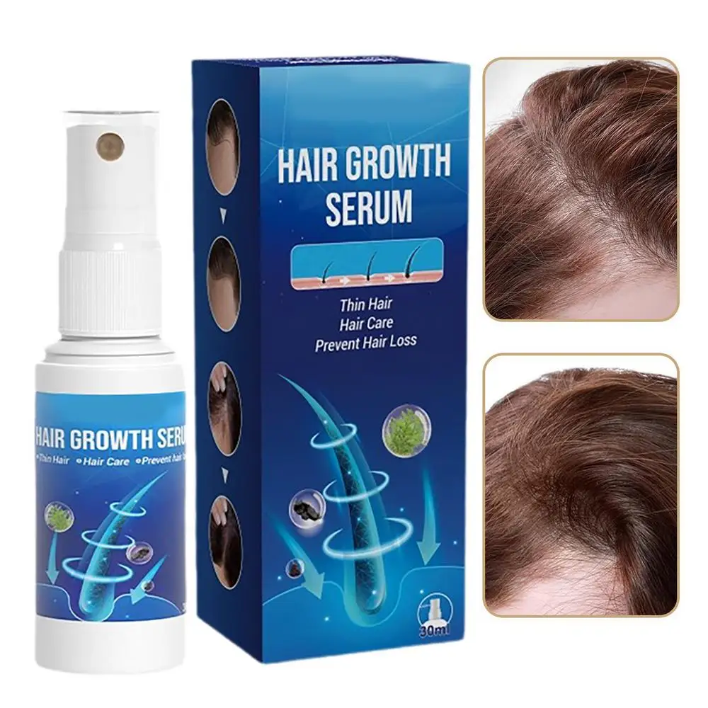 Description Picture 4 of itemNEW Hair Growth Serum Anti-Loss Hair Regrowth Treatment EssentialOil Repair Damaged Hair Roots Hair Care Product