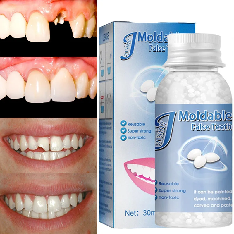 

Sdotter 10/20/30ml Temporary Tooth Repair Beads Missing Broken Teeth Dental Tooth Moldable Tooth Denture Filling False Teeth Too