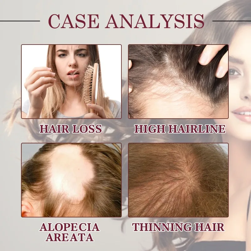 Powerful Hair Growth Serum Spray Repair Hair Nourish Root Regrowth Anti HairLoss Treatment Essence for Men Women HairCare for hair growth oil,hair restoration products,beard growth oil