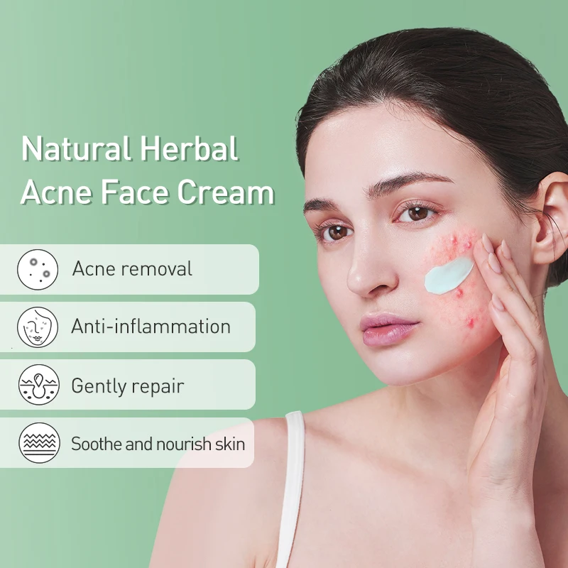 JoyPretty Herbal Skin Care Set Acne Face Cream Tea Tree Serum Treatment Pimple Removal Moisturizing Facial Products Kits 2PCS