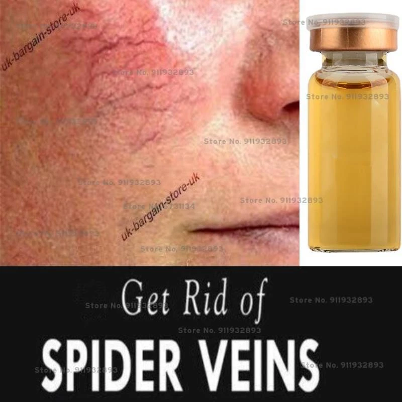 Anti Redness & Spider Vein Removal Advanced Treatment Clearer Skin