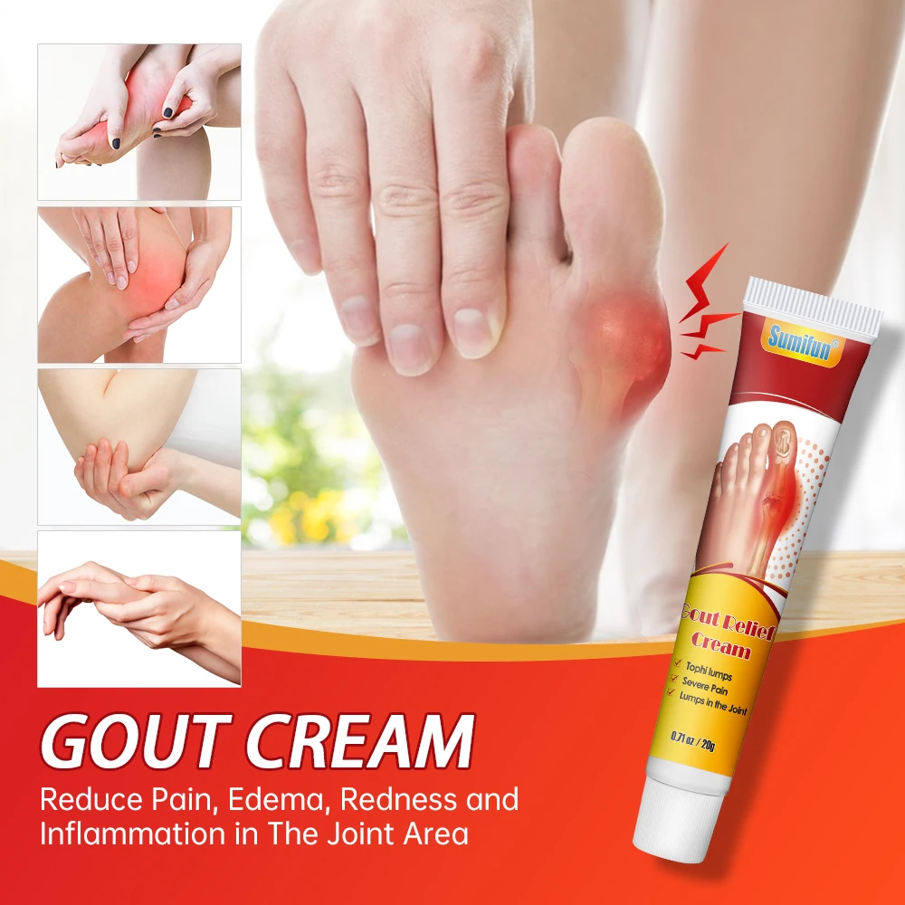 1/3/5/10/30Pc Sumifun Gout Relief Cream Bunion Hallux Valgus Toe Pain Ointment Finger Muscle Joint Swelling Ache Massage Plaster