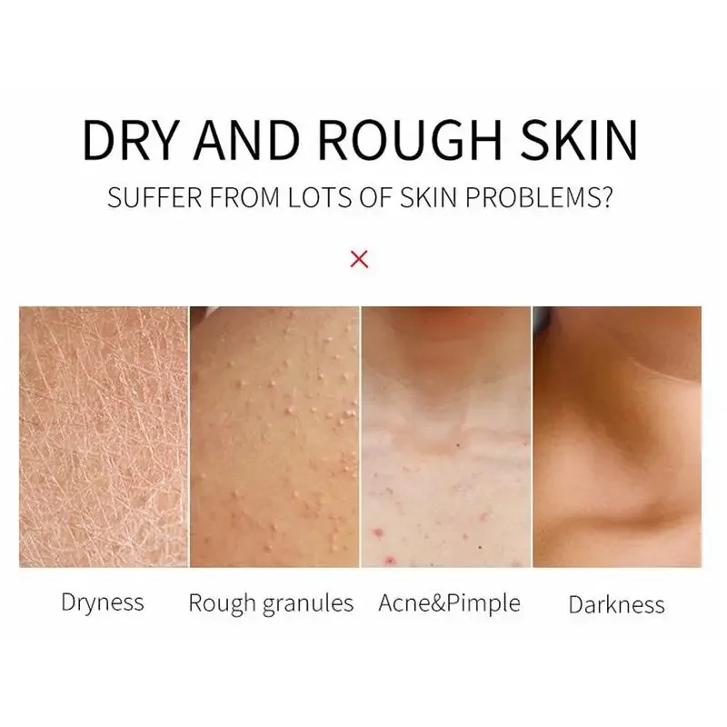 Body Scrub 100g Face Body Skin Scrub Deep Cleansing Exfoliating Hydrating Cream Mud Exfoliating Gel Body Lotion