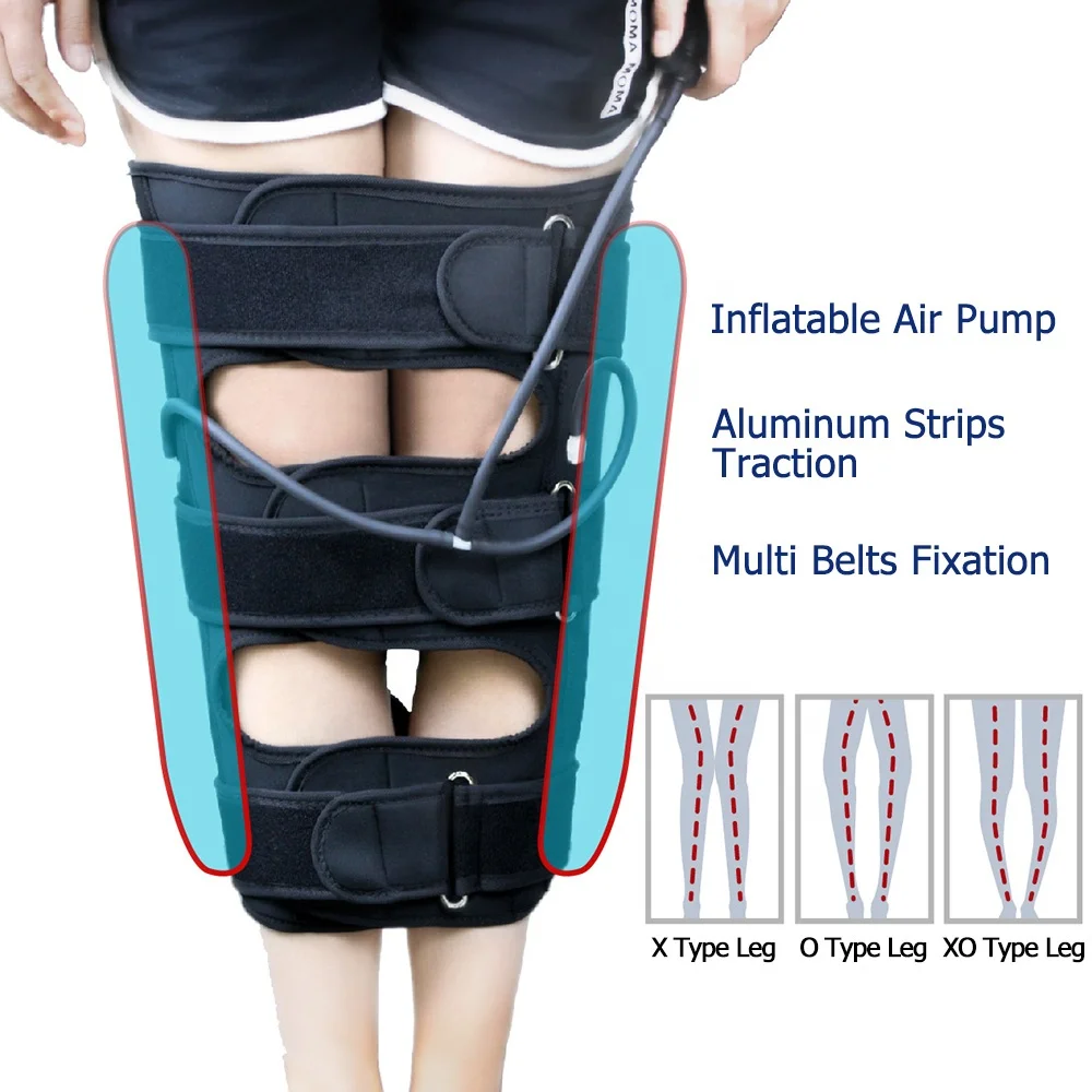 Private Label Bowed Legs Knee Valgum Straightening Posture Corrector Knee Belt For Adults Children