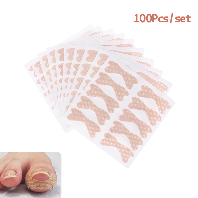 

100pcs Professional Embedded Toe Nail Corrector Sticker Toenail Care Pedicure Thumb Curl Correction Sticker