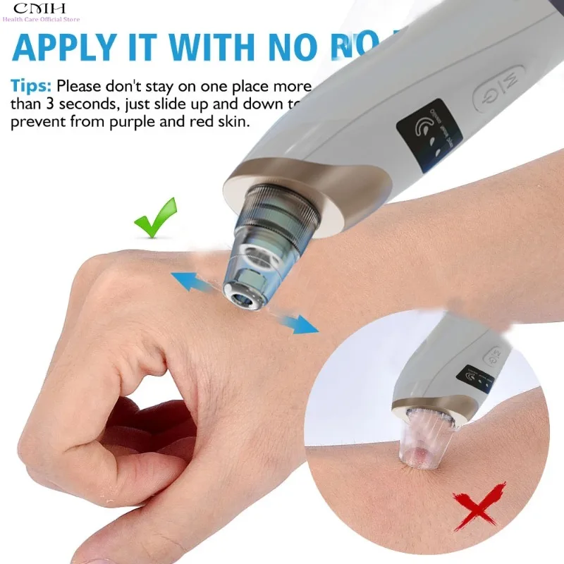 Blackhead remover vacuum for deep pore cleaning