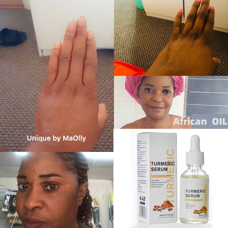 Turmeric Lemon Oil Skin Glow To Lightening Acne Dark Patches, Acne   Bright Skin Dark Spot Corrector Face Whitening Serum 3x turmeric oil skin to lightening acne dark patches acne bright skin dark spot corrector anti aging face whitening serum care