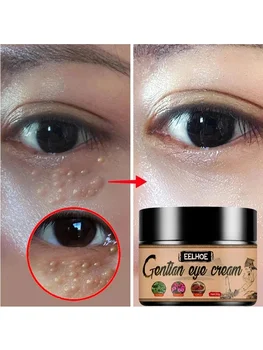 Fat Granules Remover Eye Cream Remove Dark Circles Eye Bags Fade Fine Lines Anti-Puffiness Wrinkles Lift Firming Eye Skin Care - Thumbnail 8