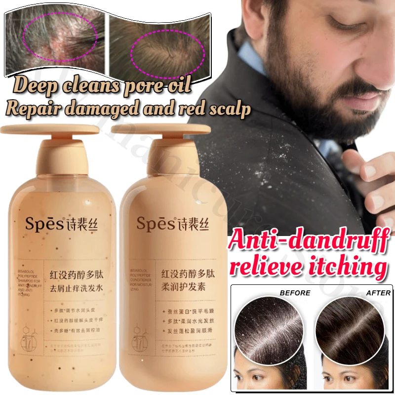 

Spes 500ml Shampoo Nourishing Smooth Anti-itch Anti-dandruff Shampoo Hyaluronic Acid Oil Control Fluffy Shampoo Conditioner