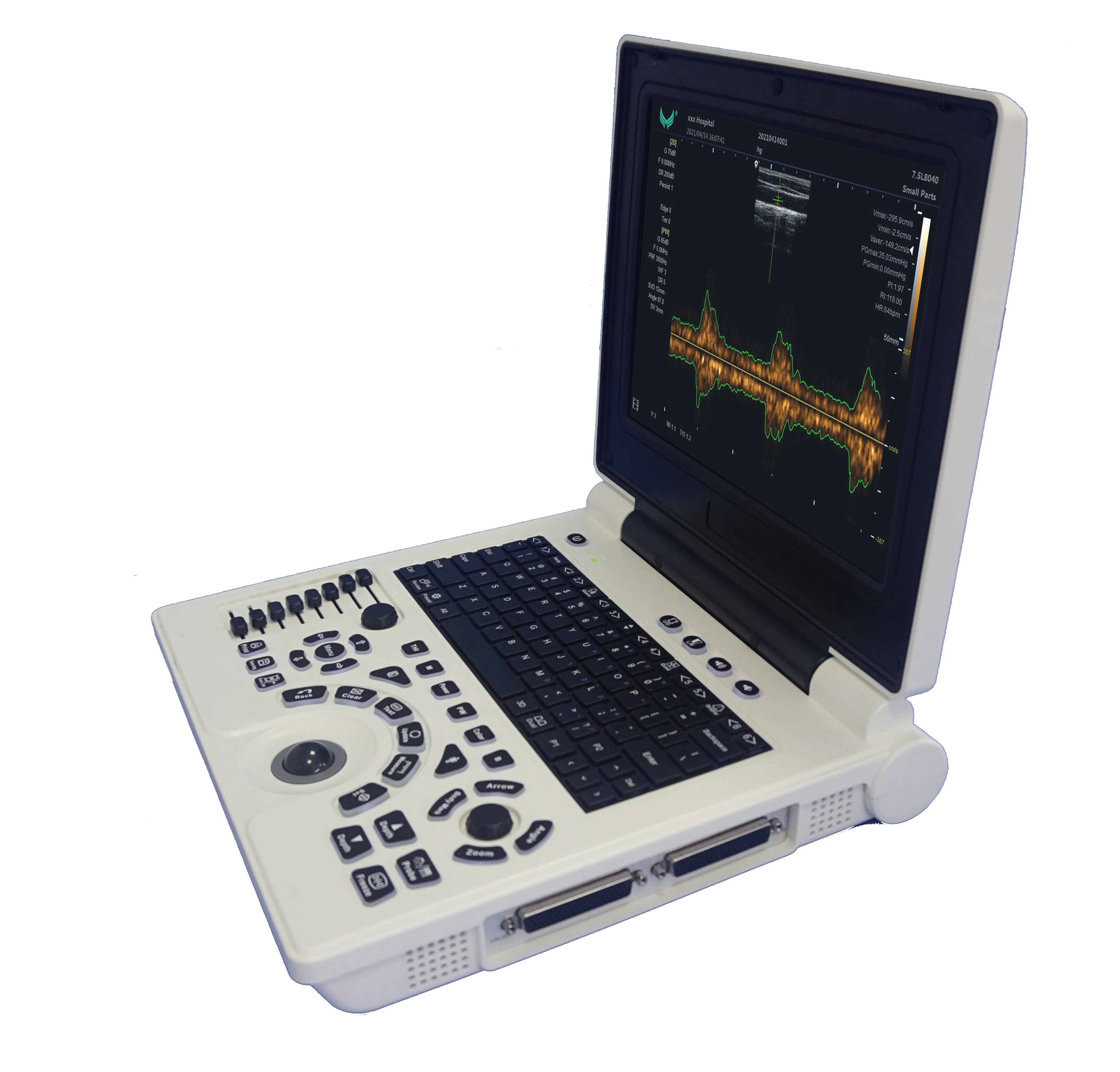 

P20 Notebook Ultrasonic Diagnostic System Buy Machine Portable Ultrasound Scanner