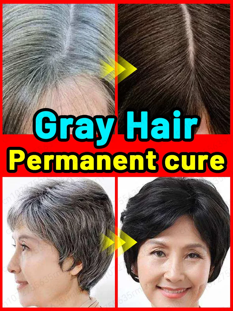 Top more than 150 grey hair solution latest camera.edu.vn