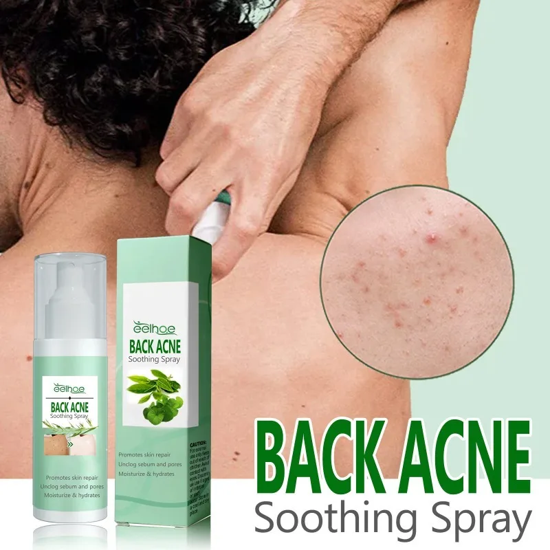 Whitening Cream Back Acne Repair Spray Acne Removal Essence Oil Oil Butt Shoulder Care Cream Control Back Whitening Moisturize Removal Spray