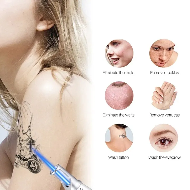 Laser Pen Therapy Laser Plasma Pen Remover Picosecond Laser Pointer for Mole Removal Dark Spot Removal Pen Tattoo Acne Skin Pigment Portable Machine Beauty Device