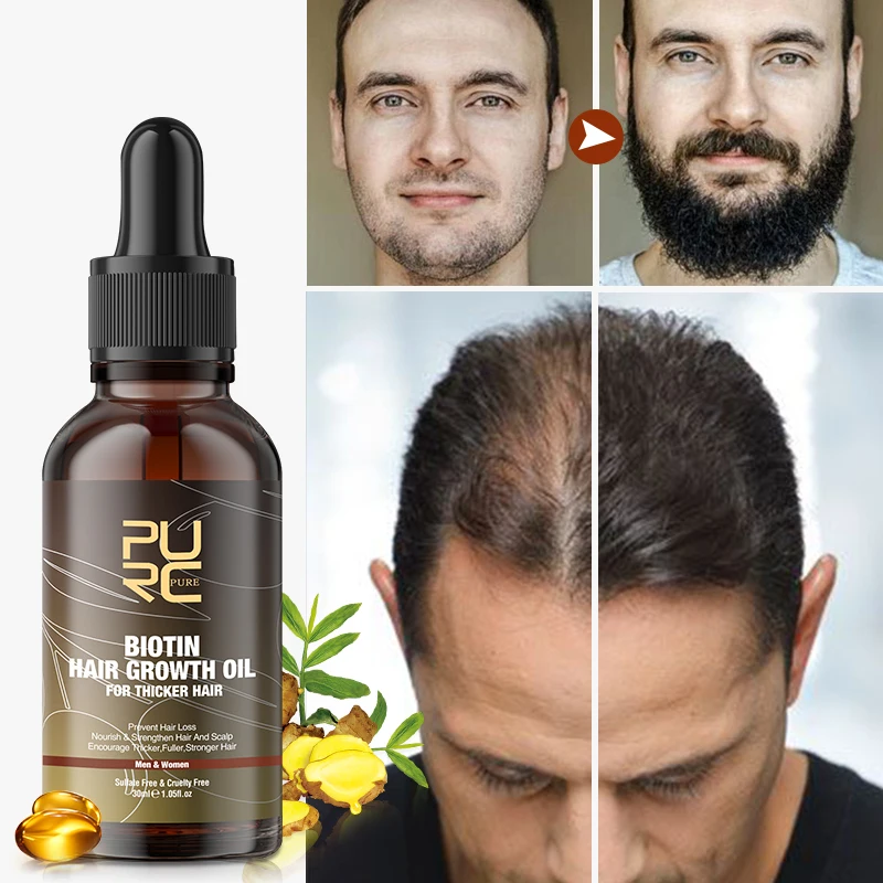 PURC Biotin Hair Oil Strengthens Weak Hair Strands Scalp Treatment For All Hair Types Beard Care Hair Care Products