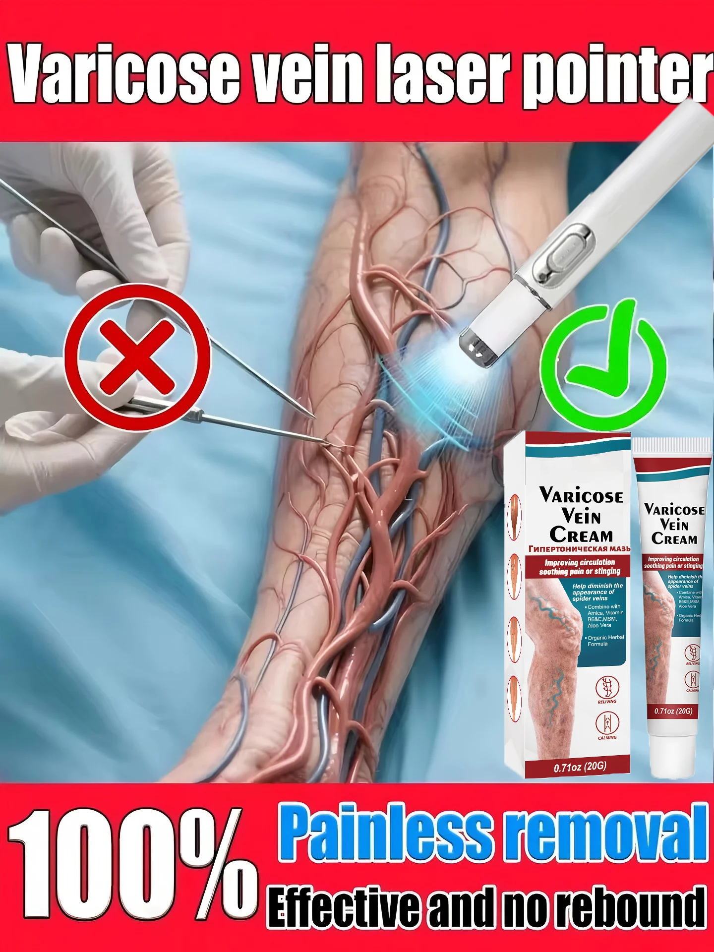 Upgraded version of the second-generation tool blue light laser combined with care cream for repairing varicose veins