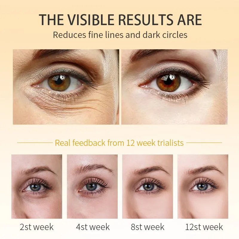 Whitening Eye Cream Eliminate Dark Circles Lighten Eye Lines Anti-aging Firm Eye Skin Smooth Fine Lines Whiten Moisturize Eyes