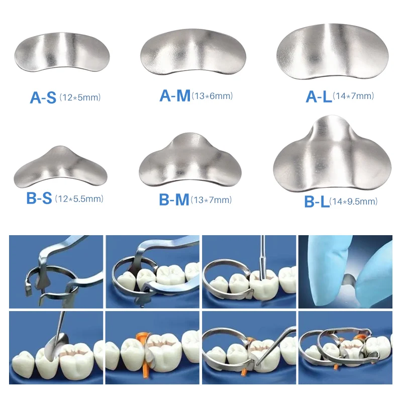 100pcs/set Dental Matrix Sectional Contoured Metal Matrices Bands