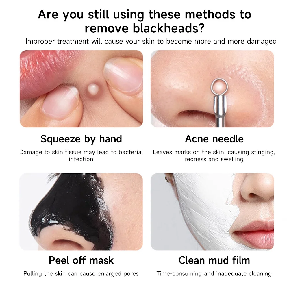 Facial Blackhead Removal Kit Facial Cleansing Remove Pimples and Blemishes Gentle Pore Clean Exfoliating Acne Removal