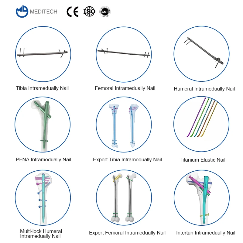 Competitive Price Gamma Nails PFNA Proximal Femoral Nail Antirotation Titanium Femur Intramedullary Nail