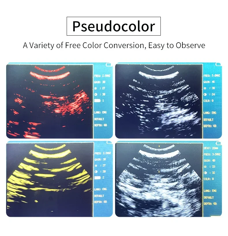 Portable Veterinary Ultrasound Scanner For Dog Cat Cattle Cow Pig Horse Ultrasou