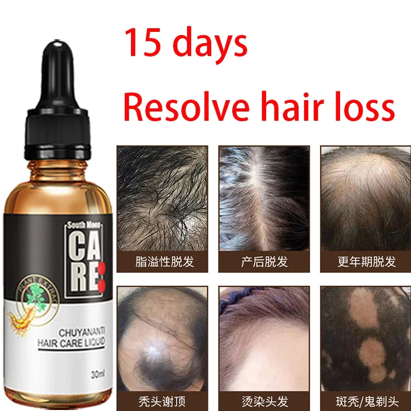 Deep repair and prevention of hair loss, hair solidification, and dense hair growth with hair care solution