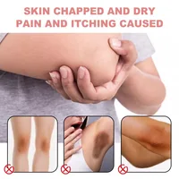 Body Private Parts Lightening Cream Bikini Area Brighten Emulsion Women Underarm Inner Thighs Brightening Cream For Dark Skin 2