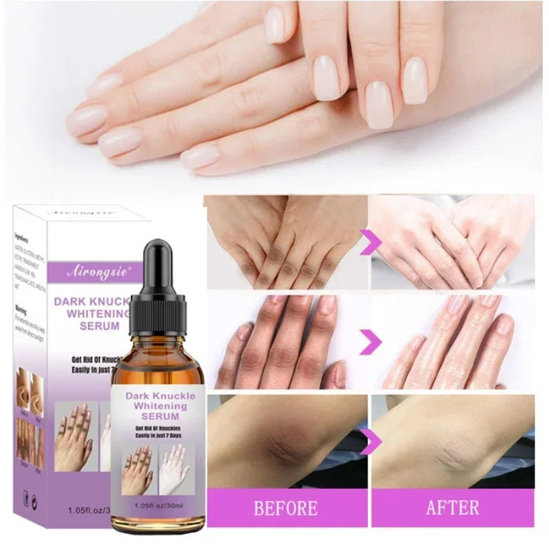 Hand Joint Knee Ankle Melanin Removal Essence Fades Skin Black Solution 30ml castor oil ankle and knee wraps square towel pack reusable essential oil nursing aid pack soft wool sleep conditioning aid tools
