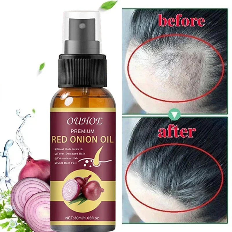 

Onion Dense Hair Essential Oil Hairs Thick Soft Strong Anti-Hair Loss Solid Hairs Moisturizing Hair Care Spray Hair Growth Oil