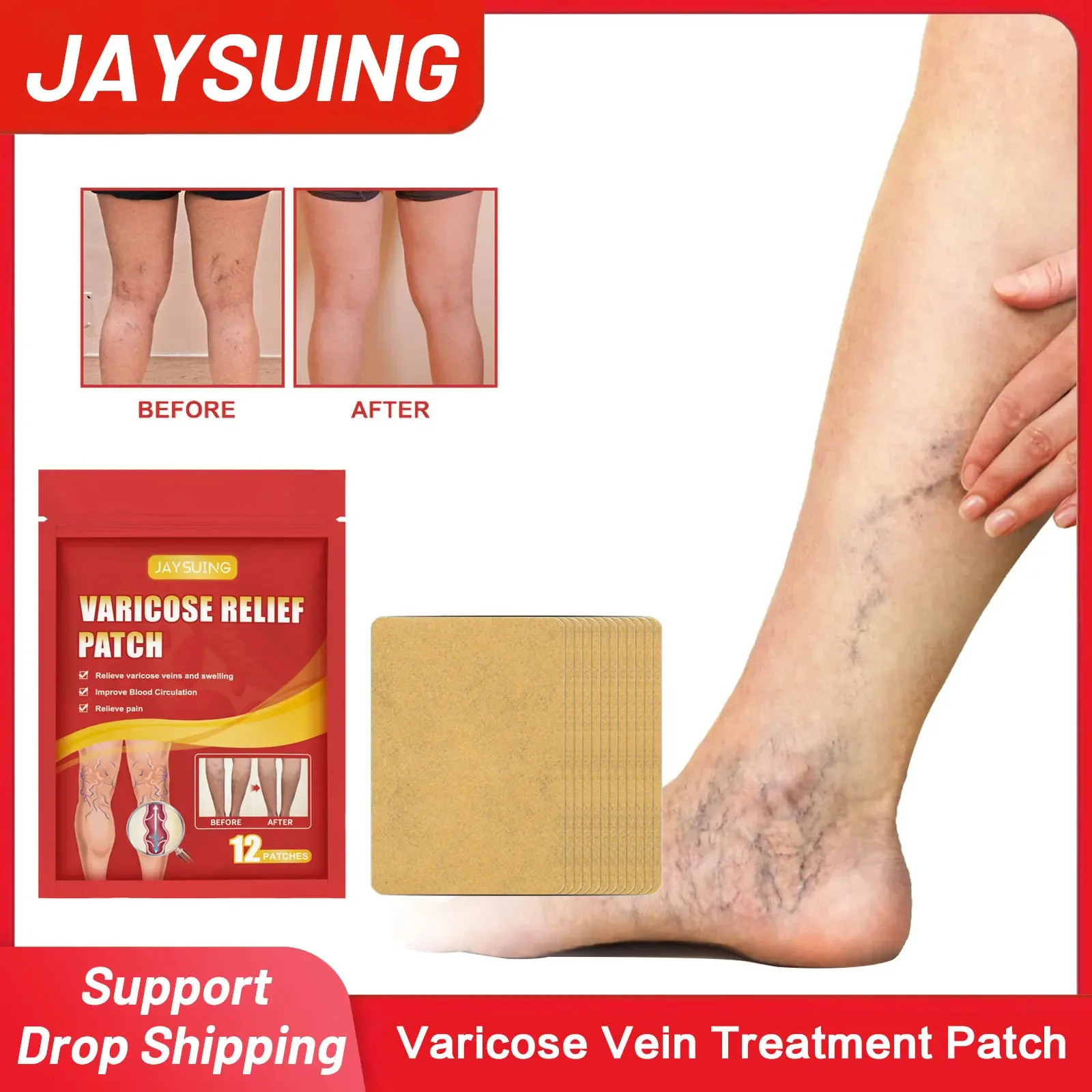 

Varicose Vein Treatment Patch Relieve Vasculitis Phlebitis Treating Foot Swelling Spider Pain Earthworm Leg Health Care Sticker