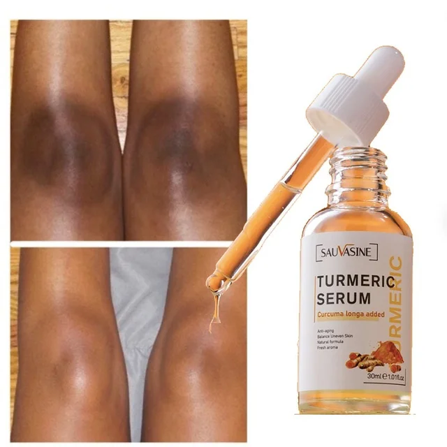 Turmeric Lemon Oil Skin Glow To Lightening Acne Dark Patches, Acne Bright Skin Dark Spot Corrector Face Whitening Serum 1