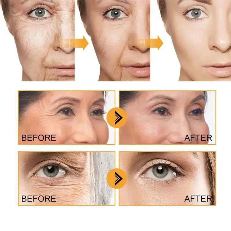 Face Lift Serums Astaxanthin Ampoule Firming Serums For Face 30ml Lifting For Brightening Firming And Hydrating