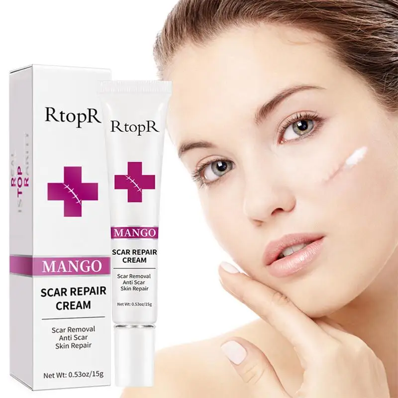 Scar Removal Cream Remove Stretch & Scar Marks Fade Dark Skin