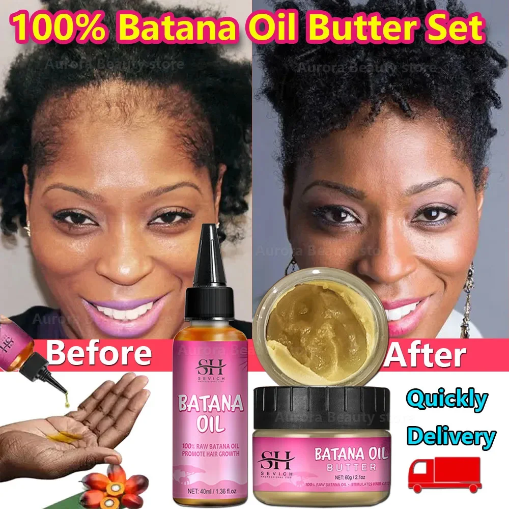 

100% Batana Hair Oil Fast Growth Oil African Crazy Traction Alopecia Batana Hair Mask Anti Break Loss Regrowth Treatment Product