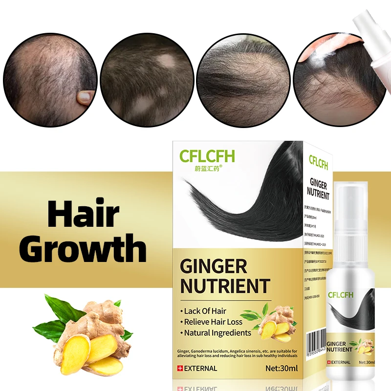 

Hair Growth Spray Anti Hair Loss Treatment Ginger Ganoderma Lucidum Care Liquid Scalp Hair Regrowth Products for Men Women 30ml