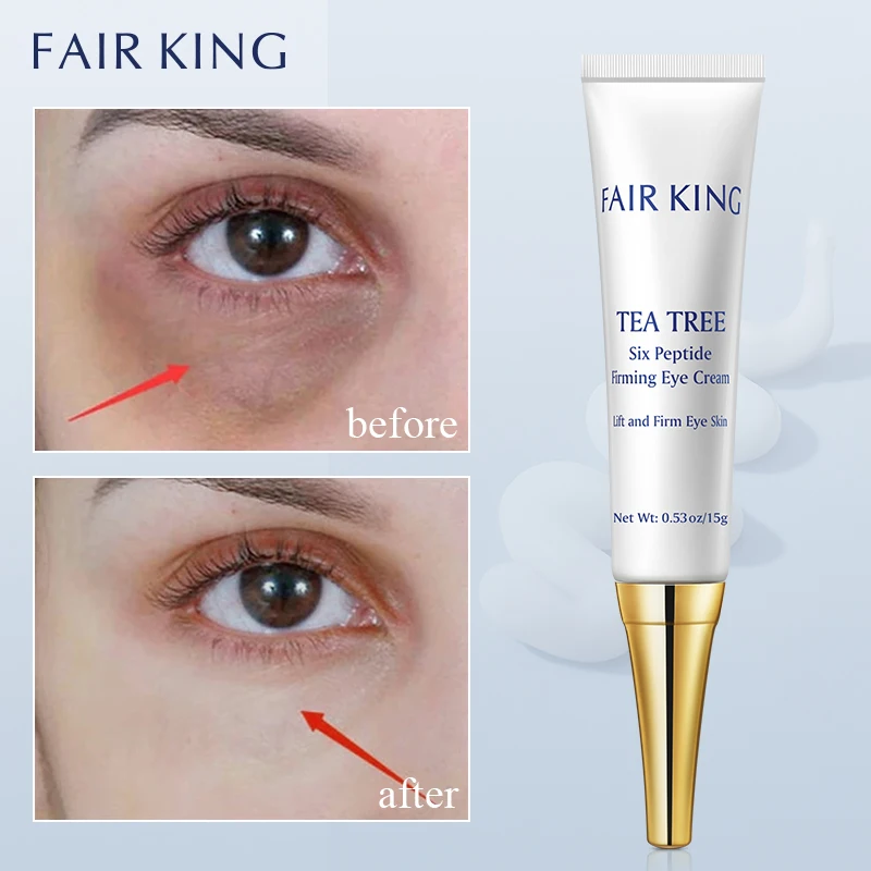 FAIR KING Tea Tree Hexapeptide Eye Cream Lighten Fine Lines Remove Dark