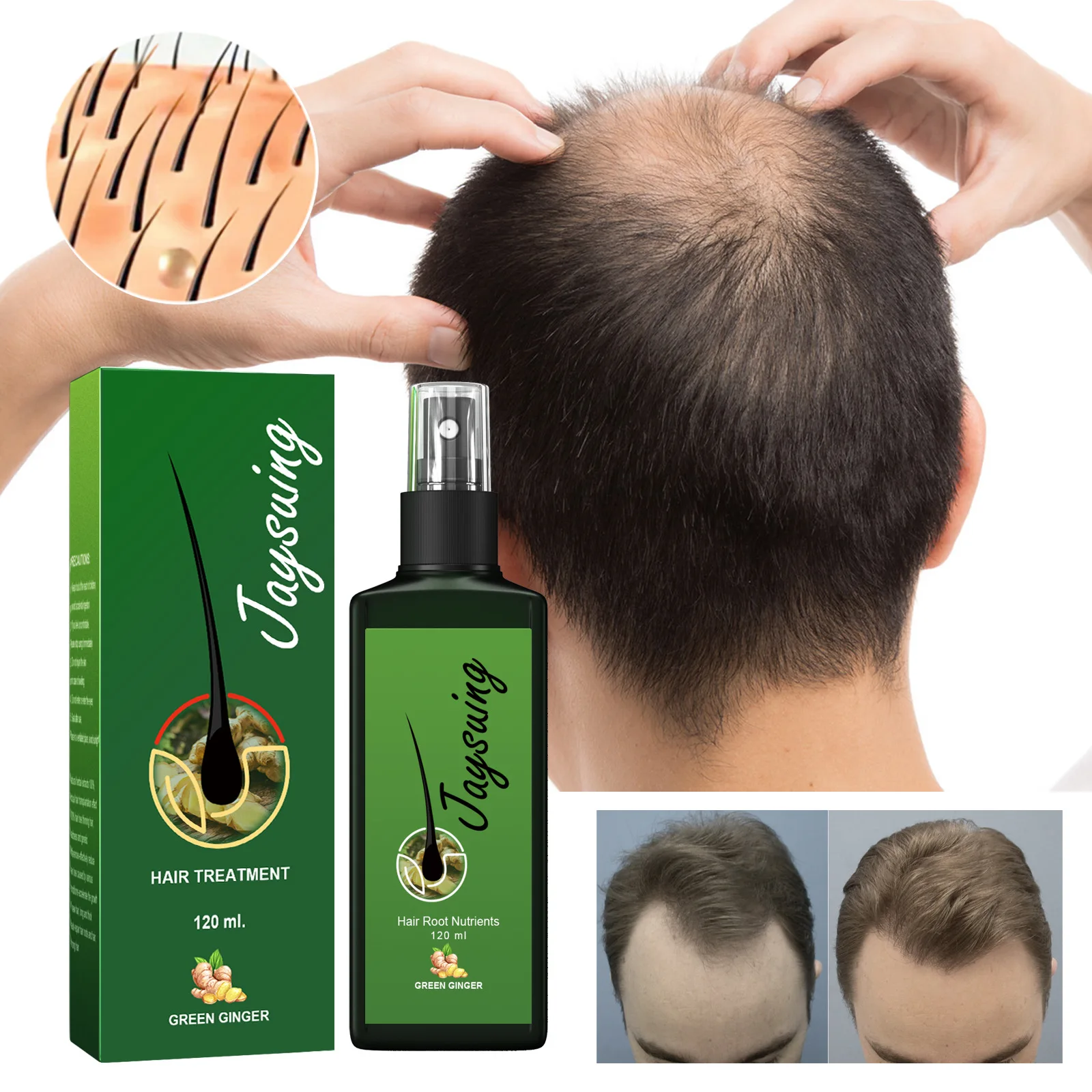 Jaysuing Hair Growth Oil Strong Hair Scalp Massage Liquid Fast Growing Germinal Anti-loss Treatment Serum Care