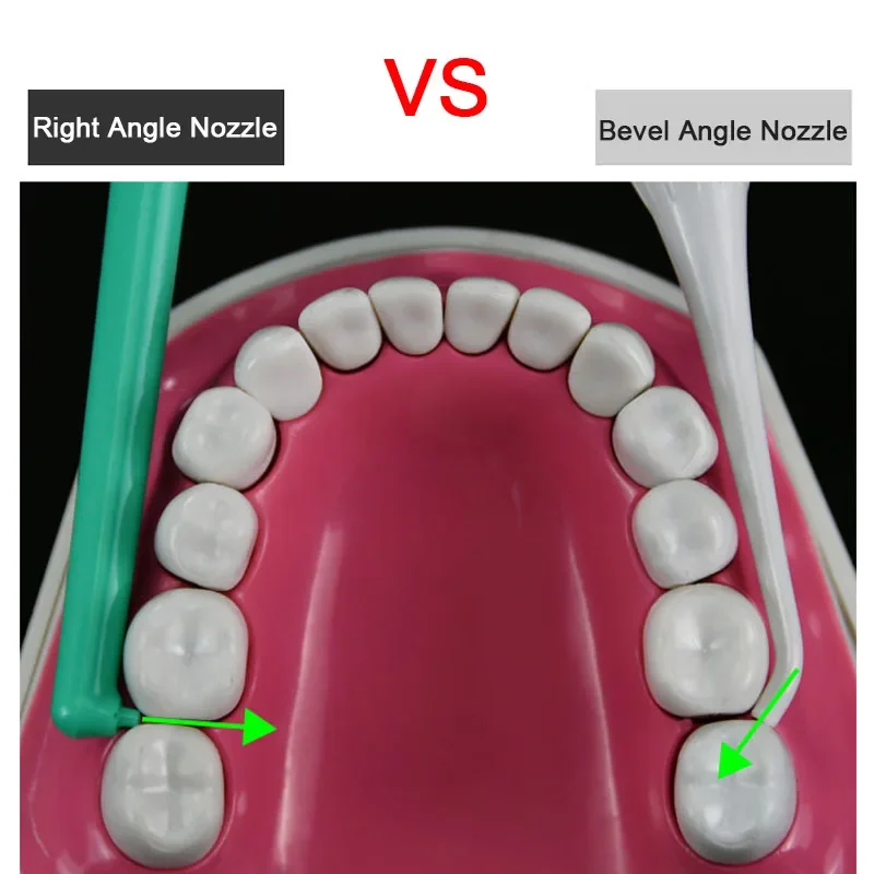 ο   Irrigator ޴ ġ Ŭ ġ  Flosser з    Ʈ Flossing  ʿ 