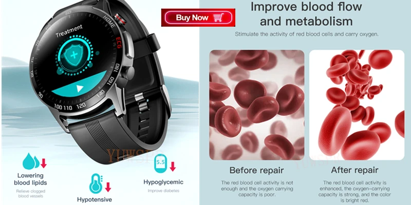 NEW Smart Watches Laser Health Assistant Heart Rate Blood Pressure Healthy Tracking Watch for Xiaomi Android 6.0 IOS 11.4 F900