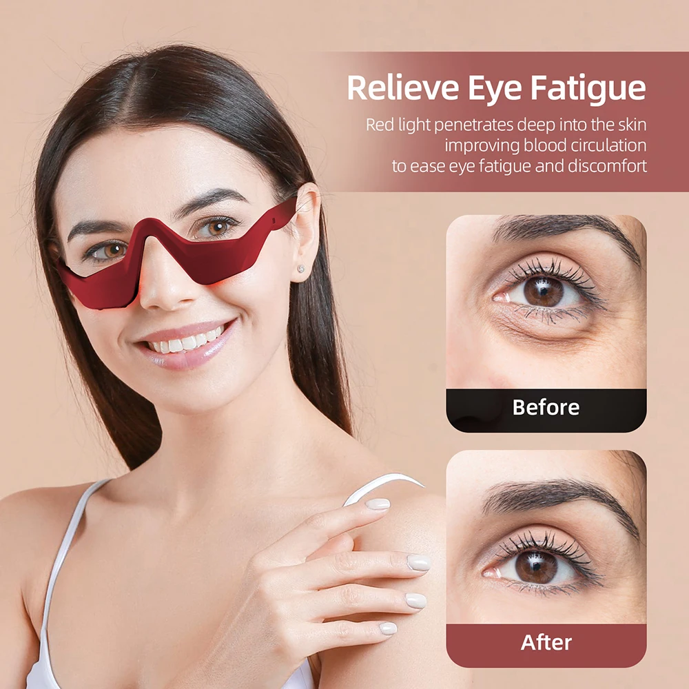 EMS Eye Massager Dark Circles Eye Bag Removal Eye Care Massage 4