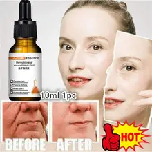  Instant Perfection Wrinkle Essence Always Young Lactobionic Acid New 10ml 