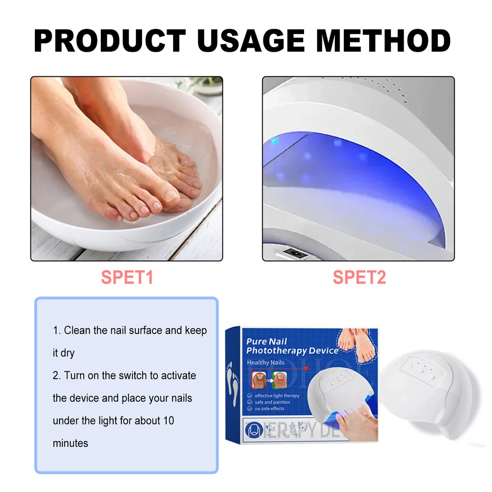 Fungal Nail Laser Treatment Device for Toenail